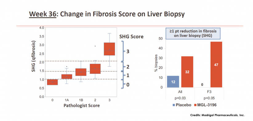 MadrigalWeek 36 Fibrosis SHG