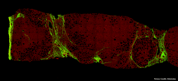 Histoindex’s Stain-Free Digital Pathology System Receives HSA Approval ...