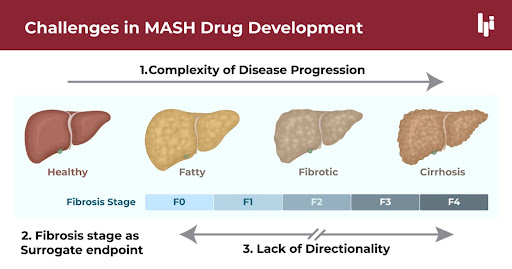 challenges in MASH drug development