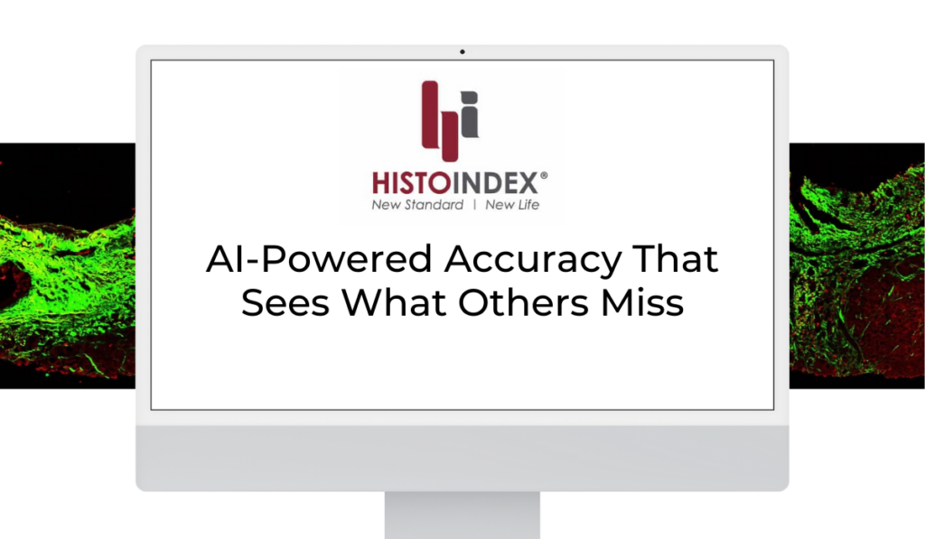 ai powered accuracy