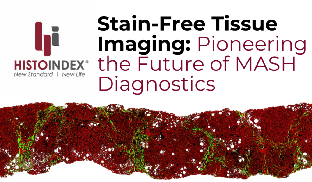 stain free tissue imaging: pioneering the future of MASH diagnosis