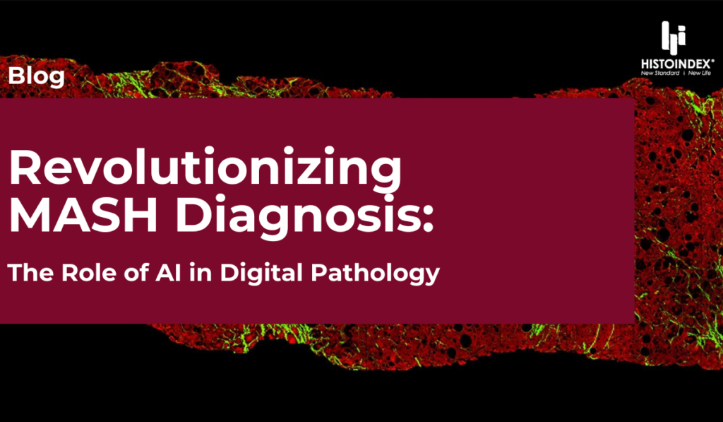 Revolutionizing MASH Diagnosis: The Role of AI in Digital Pathology