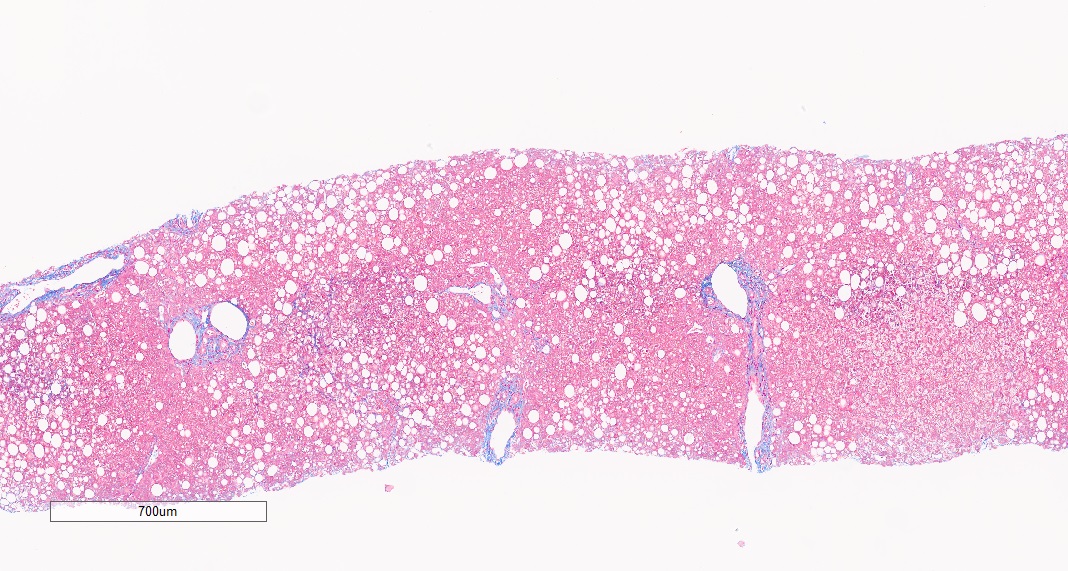 masons trichrome staining