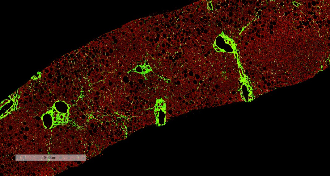 second harmonic generation imaging